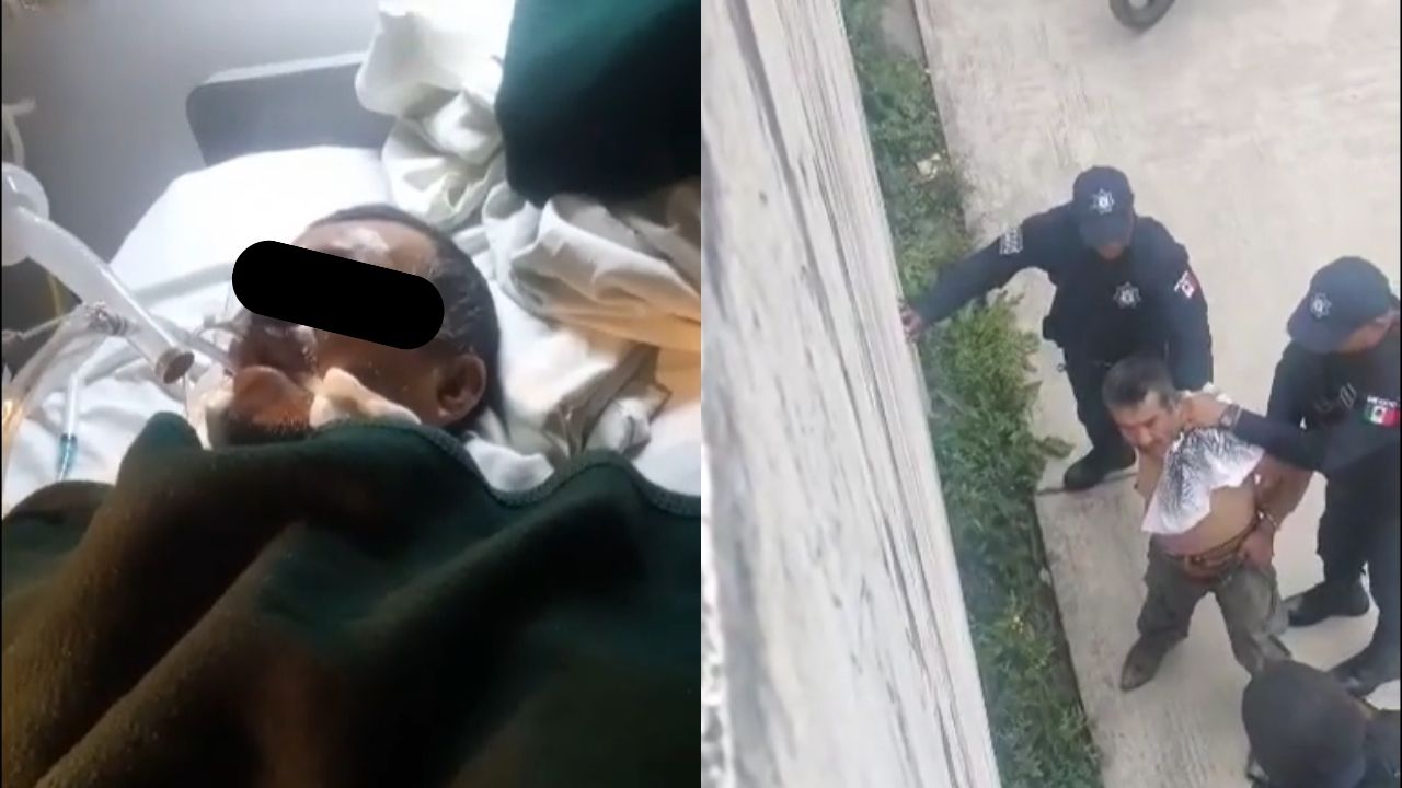 Muere hombre que fue víctima de abuso policial en Hidalgo