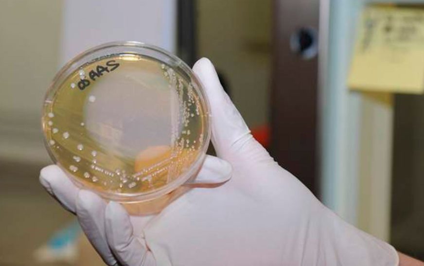 Alertan aumento de casos de una ‘bacteria carnívora’ que está afectando a Japón