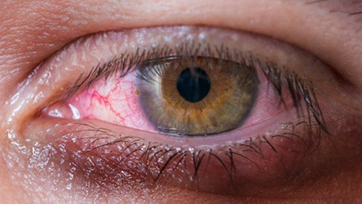 Consumo de drogas impacta negativamente a la salud visual: Medical Dimegar