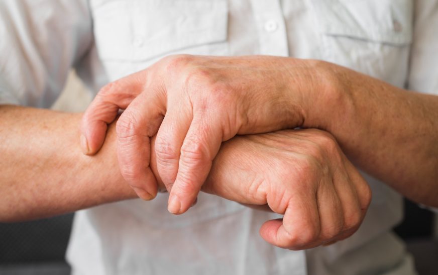 Artritis reumatoide afecta a más de 18 millones de personas en el mundo