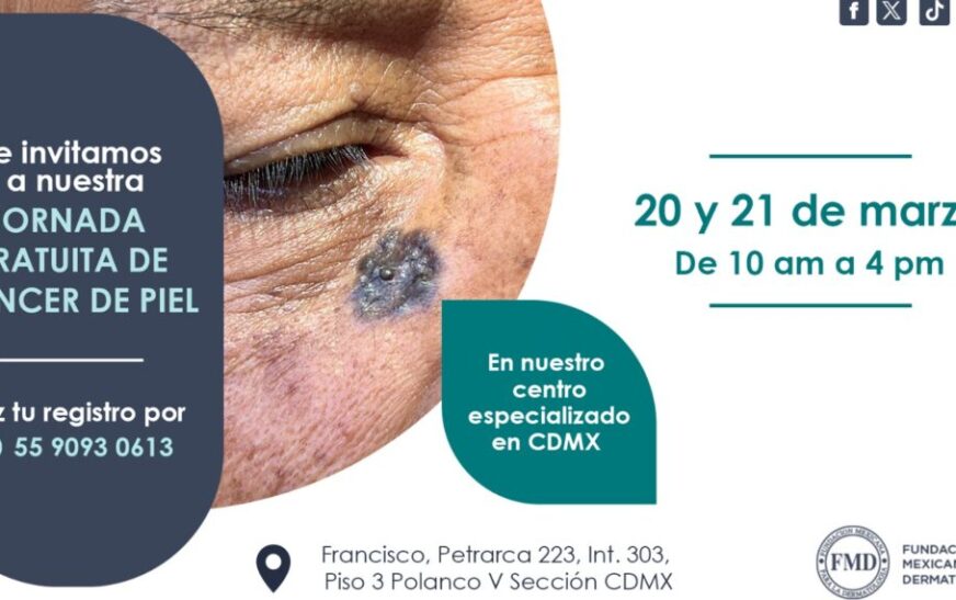 Anuncian jornada gratuita de detección de cáncer de piel en CDMX los próximos 20 y 21 de marzo