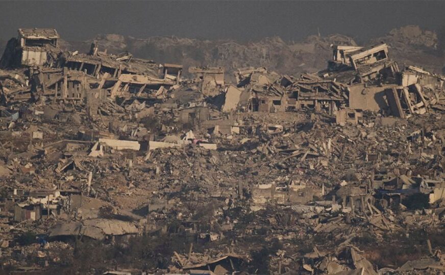 Guerra de Gaza deja a más de cuatro mil personas con amputaciones; sólo hay nueve profesionales para atenderlas