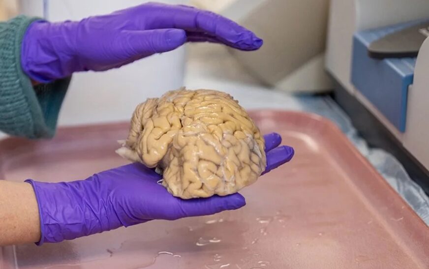 El cerebro de los ‘superancianos’ ofrece algunas claves de la eterna juventud