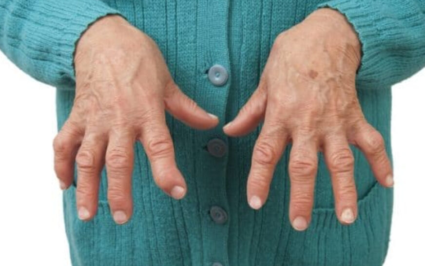 La artritis reumatoide afecta mucho más que las articulaciones: hasta 1 de cada 2 pacientes sufre síntomas depresivos